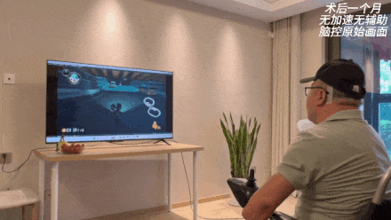 手机股票配资软件 追赶马斯克！国产超柔性微创植入式脑机接口让截肢者“脑控”玩游戏